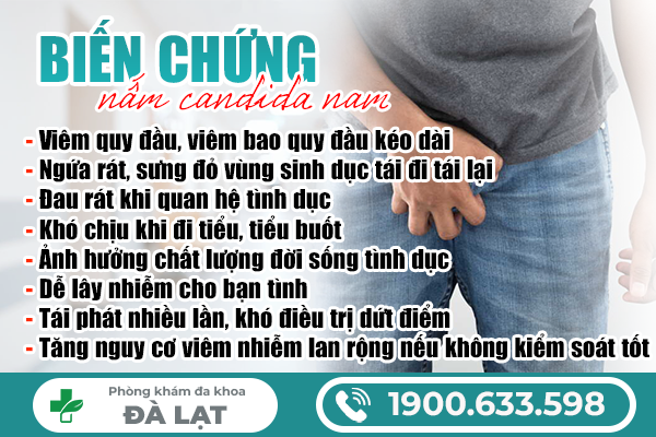 Hình ảnh minh họa